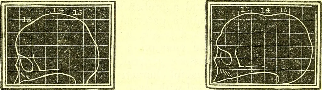 An illustration from Outlines of prenology., 1836, leaf 18