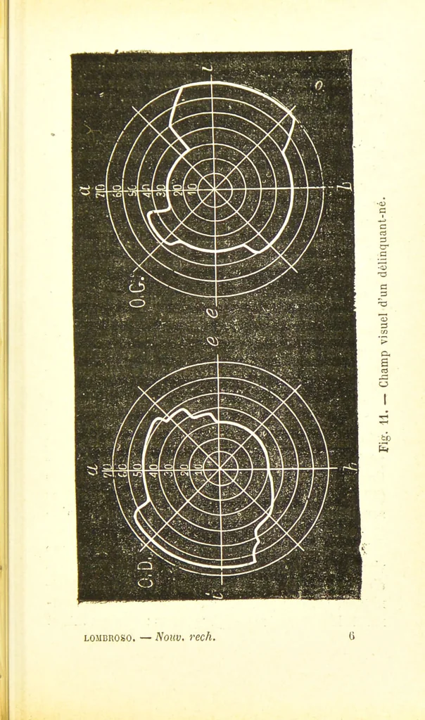 An illustration from Nouvelles recherches de psychiatrie et d'anthropologie criminelle / par Cesare Lombroso., 1892, leaf 105