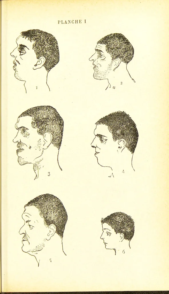 An illustration from Nouvelles recherches de psychiatrie et d'anthropologie criminelle / par Cesare Lombroso., 1892, leaf 57