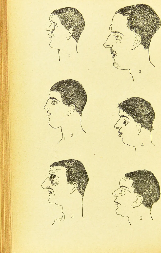 An illustration from Nouvelles recherches de psychiatrie et d'anthropologie criminelle / par Cesare Lombroso., 1892, leaf 58