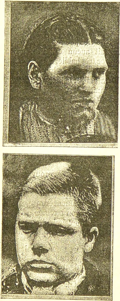 An illustration from Nouvelles recherches de psychiatrie et d'anthropologie criminelle / par Cesare Lombroso., 1892, leaf 59