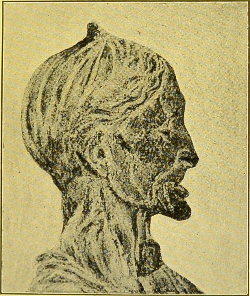 An illustration from The female offender / by Cæsar Lombroso and William Ferrero ; with an introduction by W. Douglas Morrison., 1895, leaf 111