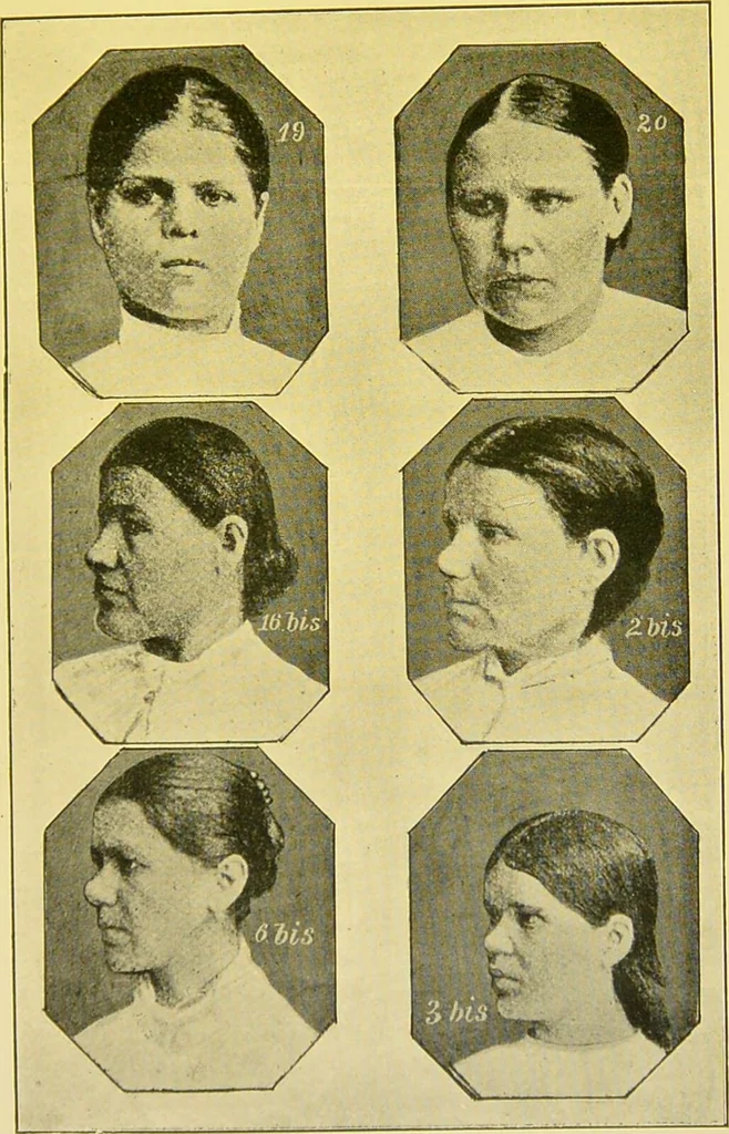 An illustration from The female offender / by Cæsar Lombroso and William Ferrero ; with an introduction by W. Douglas Morrison., 1895, leaf 123