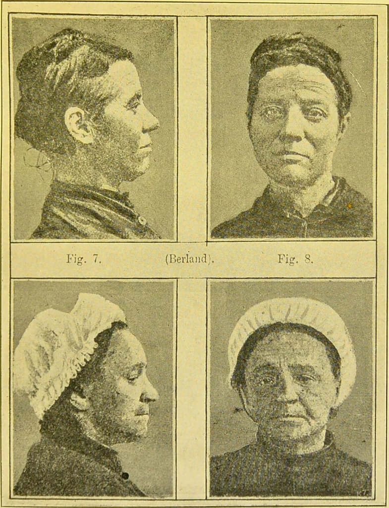 An illustration from The female offender / by Cæsar Lombroso and William Ferrero ; with an introduction by W. Douglas Morrison., 1895, leaf 149