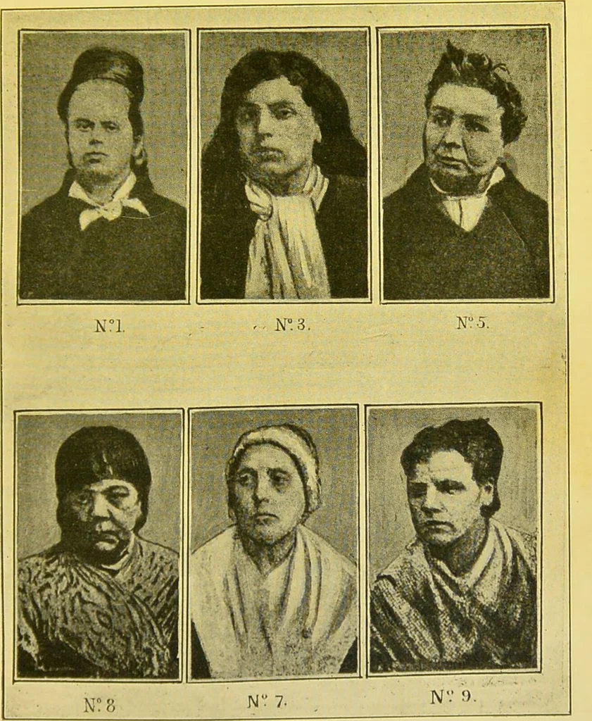 An illustration from The female offender / by Cæsar Lombroso and William Ferrero ; with an introduction by W. Douglas Morrison., 1895, leaf 167