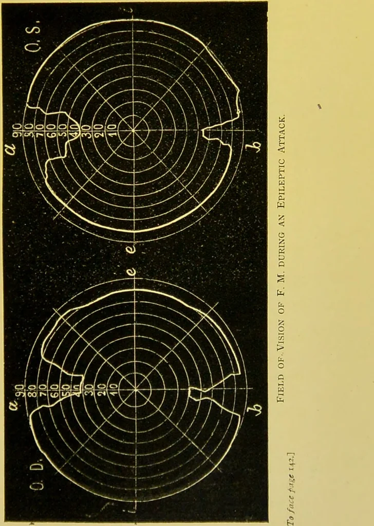 An illustration from The female offender / by Cæsar Lombroso and William Ferrero ; with an introduction by W. Douglas Morrison., 1895, leaf 219