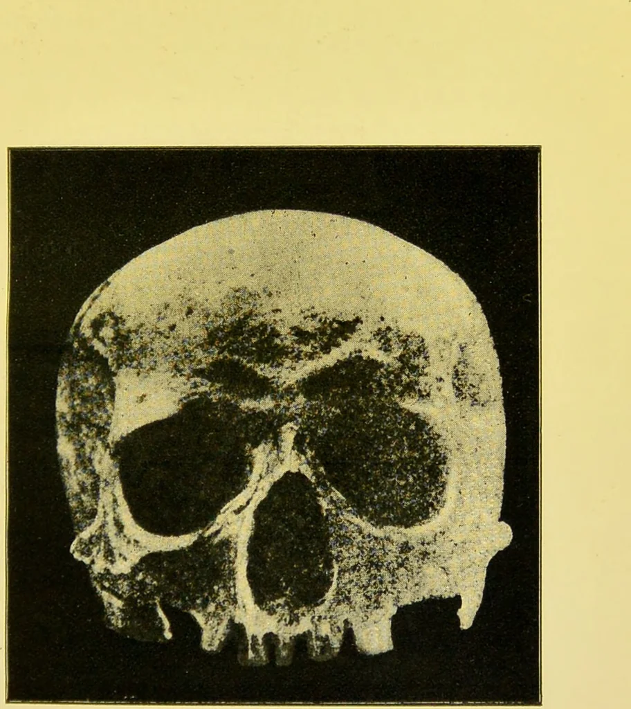 An illustration from The female offender / by Cæsar Lombroso and William Ferrero ; with an introduction by W. Douglas Morrison., 1895, leaf 71