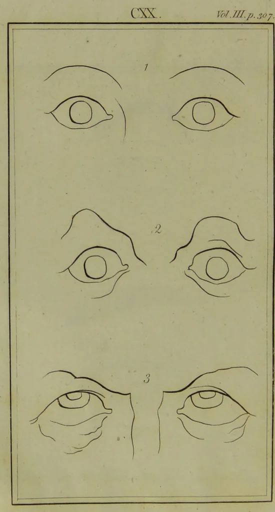 An illustration from Essays on physiognomy : for the promotion of the knowledge and the love of mankind / written in the German language by John Caspar Lavater ; and translated into English by Thomas Holcroft., 1804, leaf 150