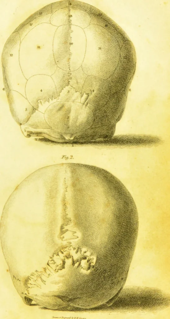 An illustration from Illustrations of phrenology / by Sir G. S. Mackenzie., 1820, leaf 291