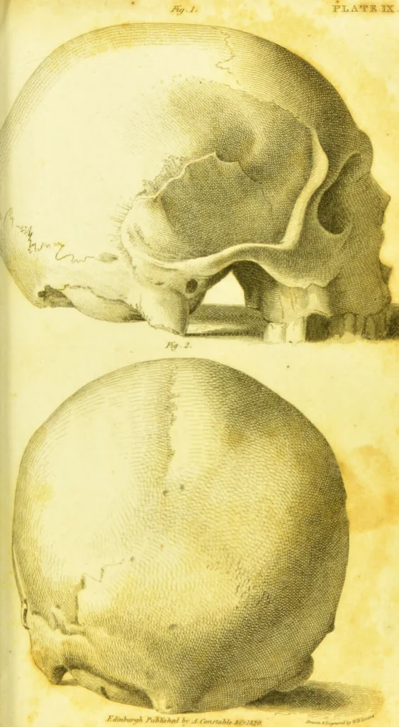 An illustration from Illustrations of phrenology / by Sir G. S. Mackenzie., 1820, leaf 305