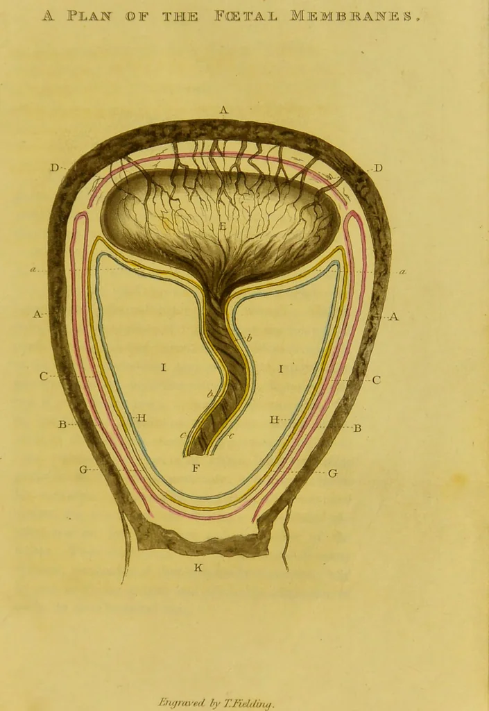 An illustration from Outlines of medico-chirurgical science ; containing remarks on medical education, and illustrations of the application of anatomy, physiology, and pathology, to the principal practical points of medicine and surgery. With coloured plates / [by] Thomas Turner., 1827, leaf 43
