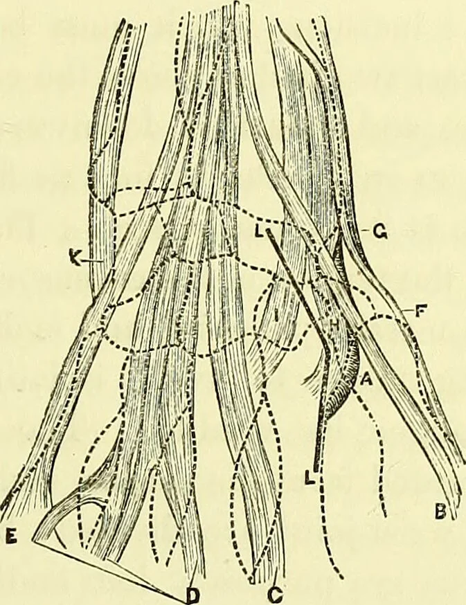 An illustration from A course of operative surgery / with plates drawn from nature by M. Léveillé and coloured by hand under his direction ; by Christopher Heath., 1877, leaf 127