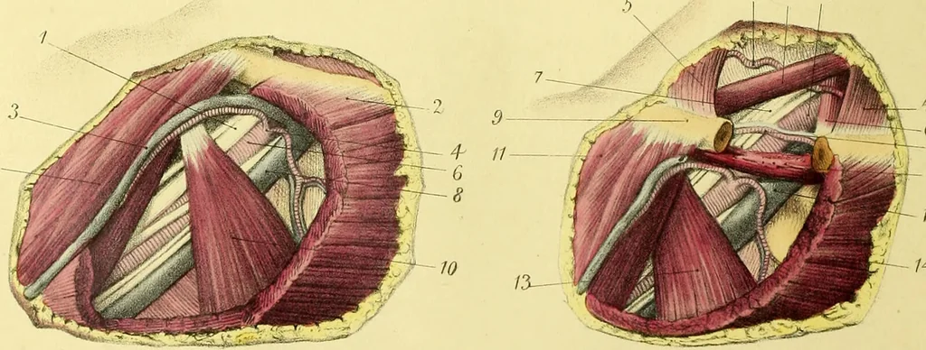 An illustration from A course of operative surgery / with plates drawn from nature by M. Léveillé and coloured by hand under his direction ; by Christopher Heath., 1877, leaf 40
