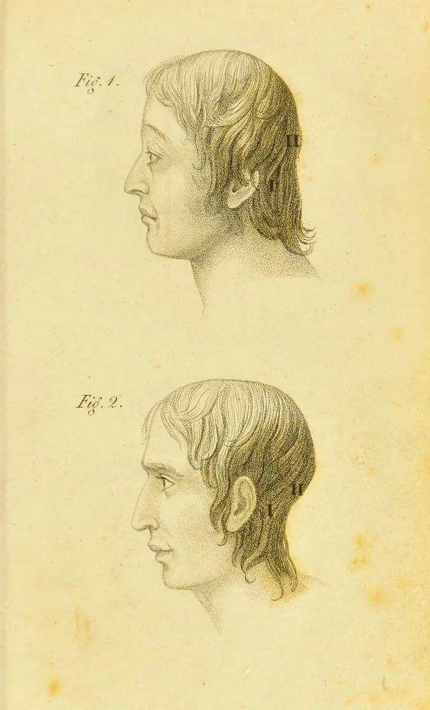 An illustration from Phrenology, or, The doctrine of the mind : and of the relations between its manifestations and the body / by J. Spurzheim., 1825, leaf 325