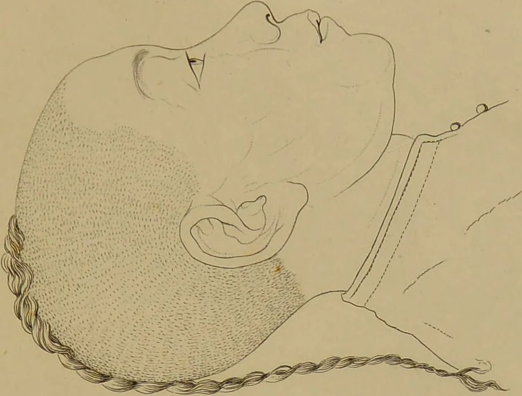 An illustration from Principes et résumé de physiognomie / par le docteur B*** D***., 1859, leaf 125