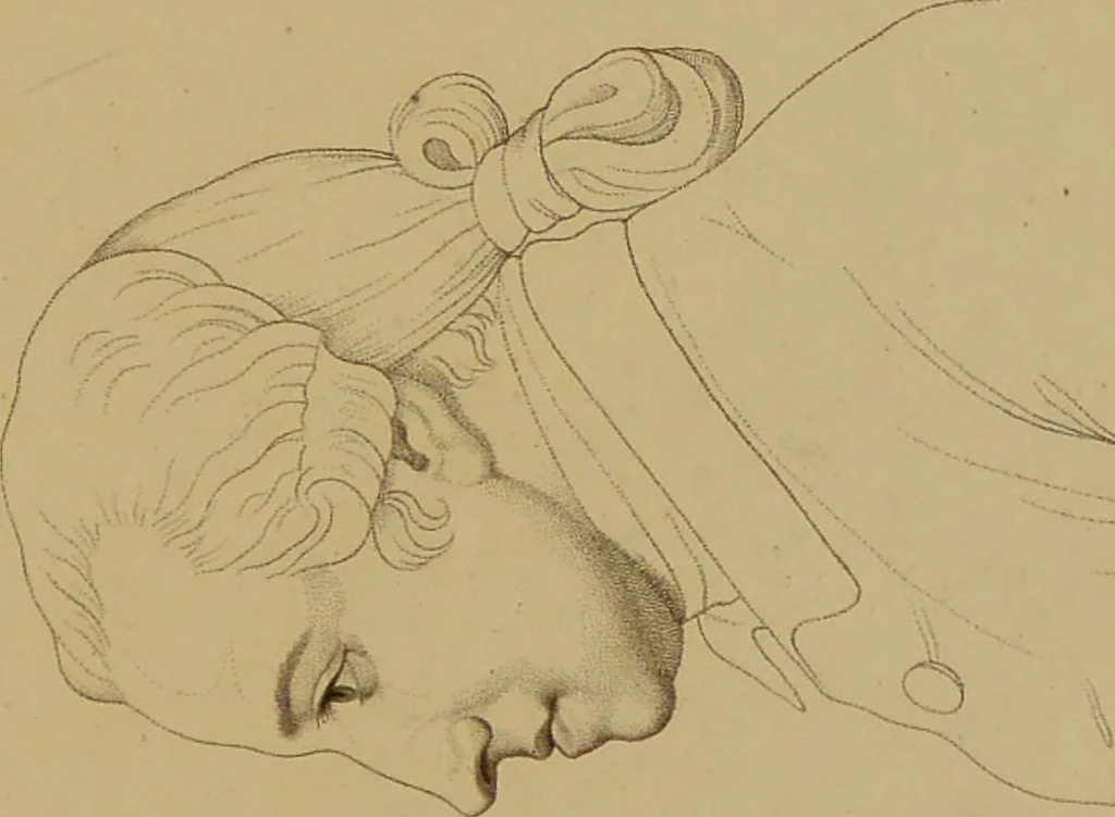 An illustration from Principes et résumé de physiognomie / par le docteur B*** D***., 1859, leaf 133