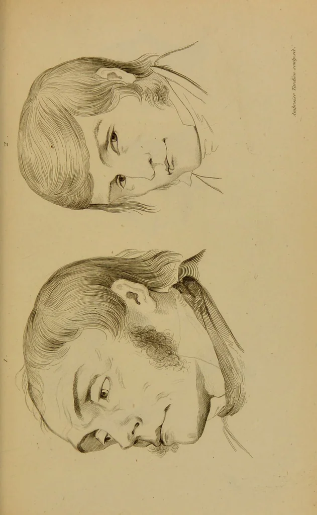 An illustration from Principes et résumé de physiognomie / par le docteur B*** D***., 1859, leaf 137
