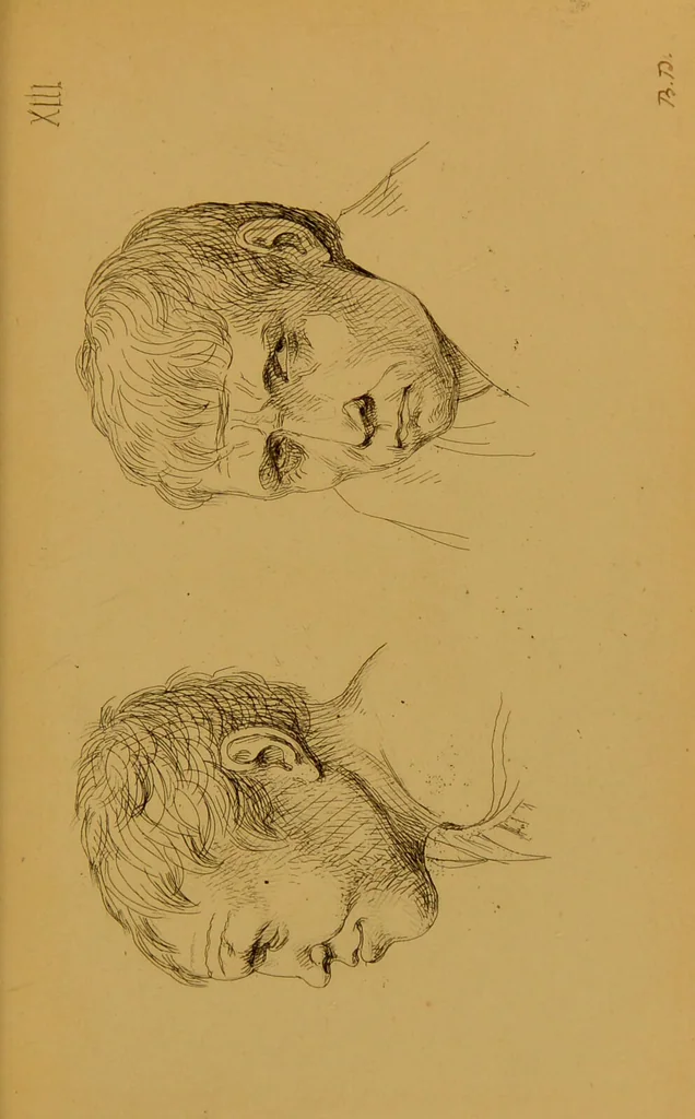 An illustration from Principes et résumé de physiognomie / par le docteur B*** D***., 1859, leaf 141