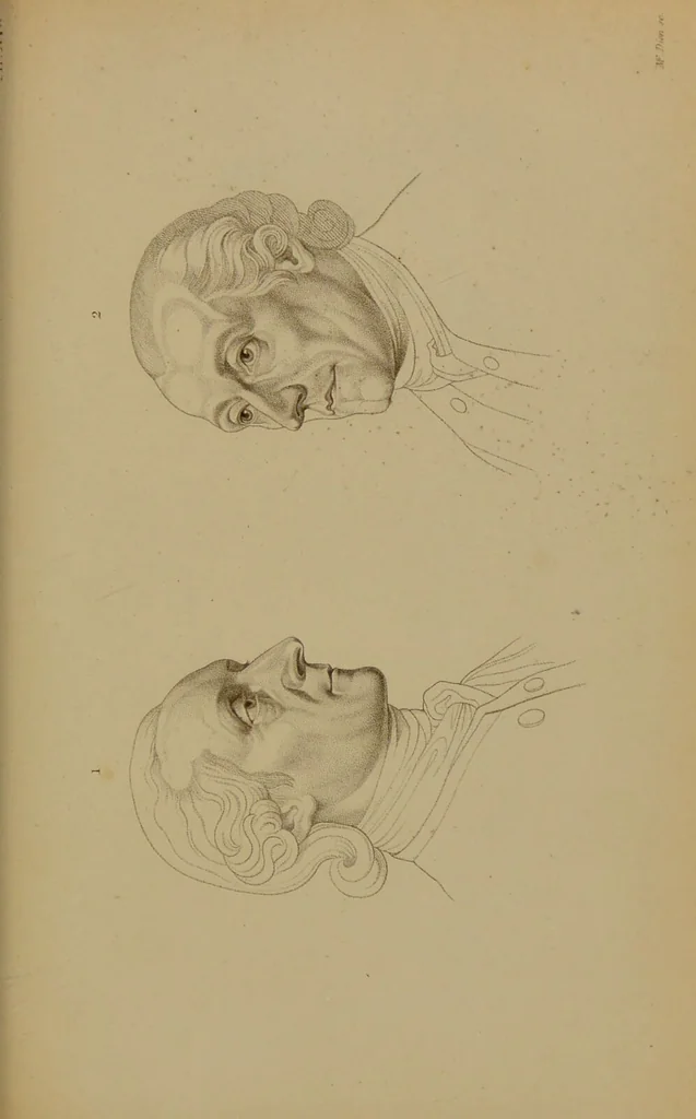An illustration from Principes et résumé de physiognomie / par le docteur B*** D***., 1859, leaf 151