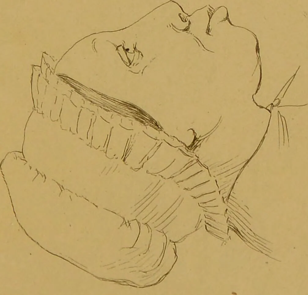 An illustration from Principes et résumé de physiognomie / par le docteur B*** D***., 1859, leaf 155