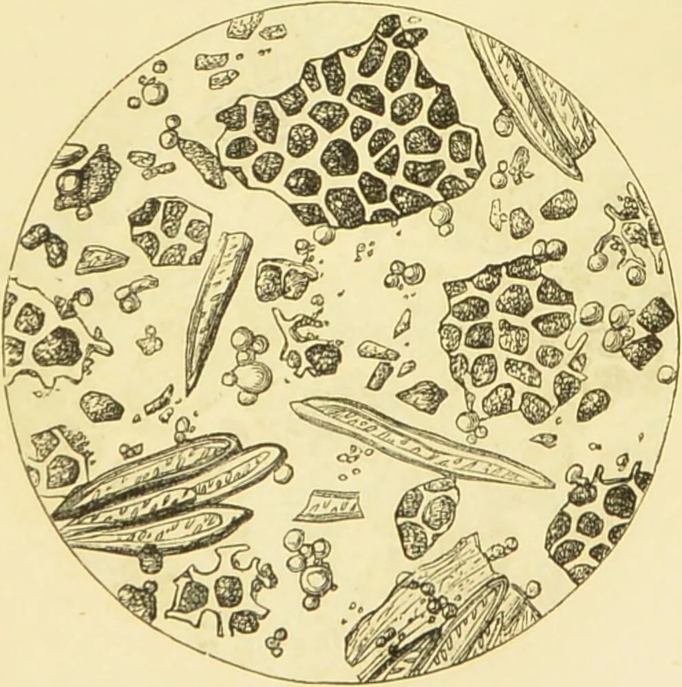 An illustration from The microscope: its history, construction, and application : being a familiar introduction to the use of the instrument and the study of microscopical sciences / by Jabez Hogg., 1869, leaf 378