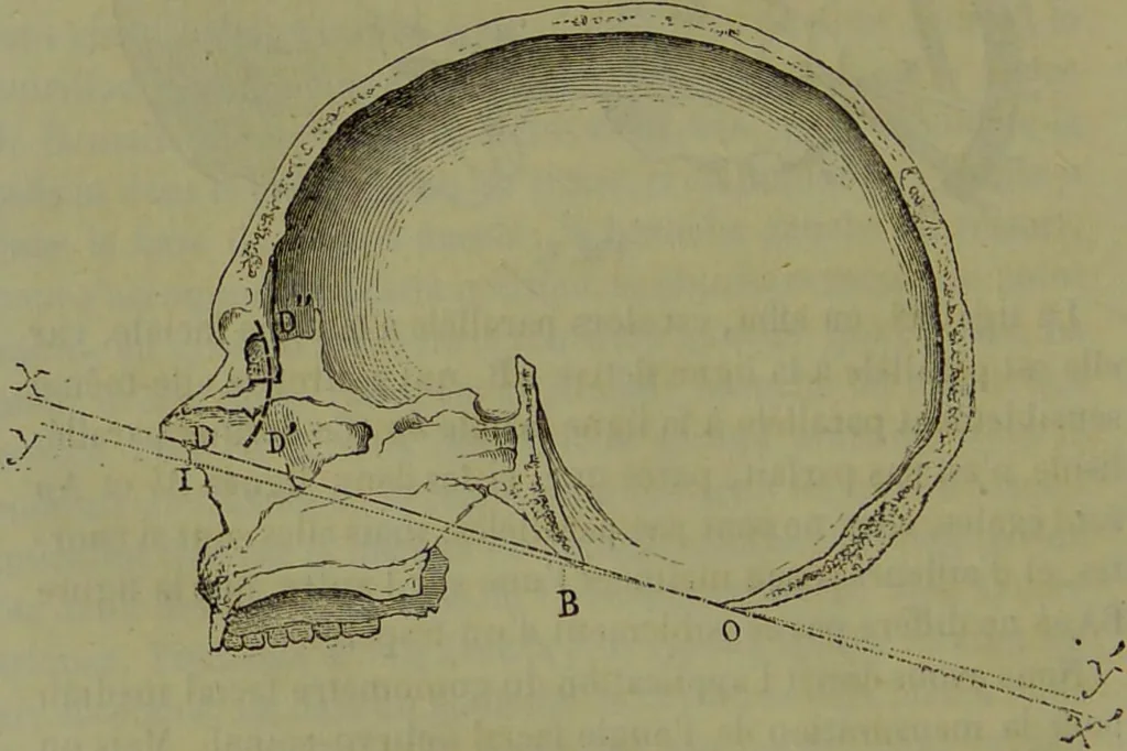 An illustration from Instructions craniologiques et craniométriques de la Société d'anthropologie de Paris / par Paul Broca., 1875, leaf 100