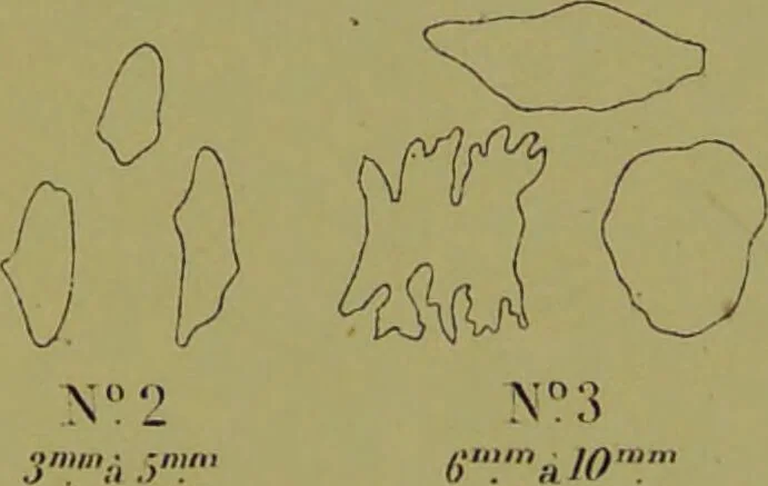 An illustration from Instructions craniologiques et craniométriques de la Société d'anthropologie de Paris / par Paul Broca., 1875, leaf 232