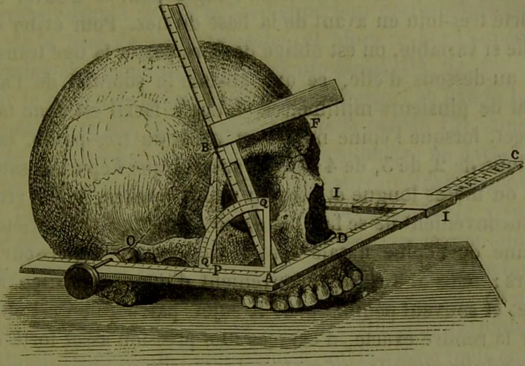 An illustration from Instructions craniologiques et craniométriques de la Société d'anthropologie de Paris / par Paul Broca., 1875, leaf 95