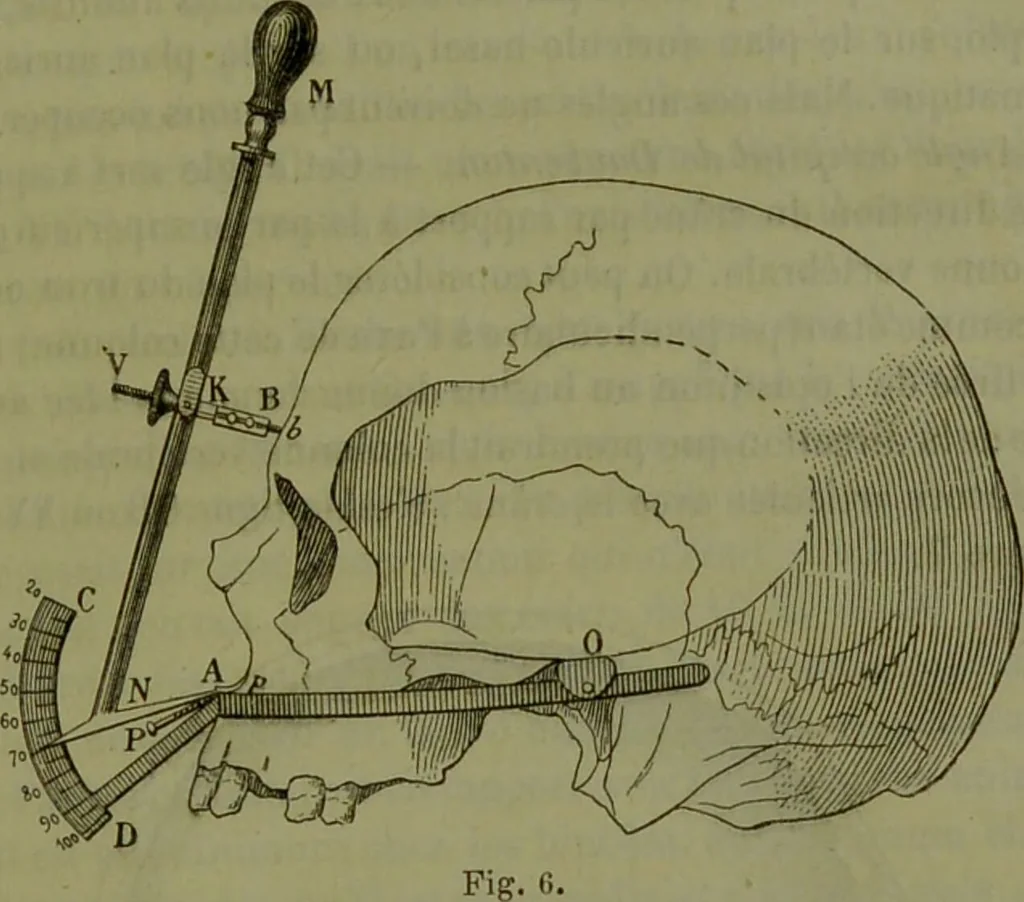 An illustration from Instructions craniologiques et craniométriques de la Société d'anthropologie de Paris / par Paul Broca., 1875, leaf 99
