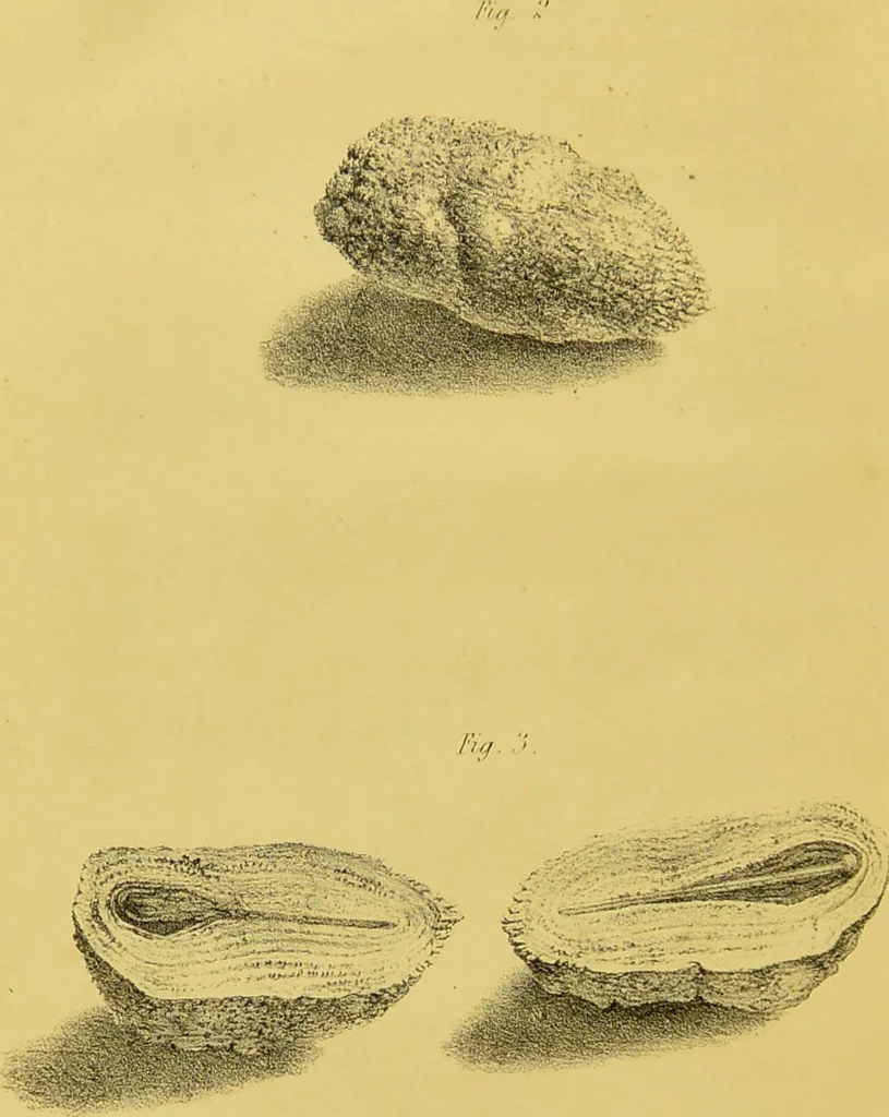 An illustration from Further observations on the variolæ vaccinæ, illustrated with coloured engravings from original drawings / By Robert Ceely., 1842, leaf 204