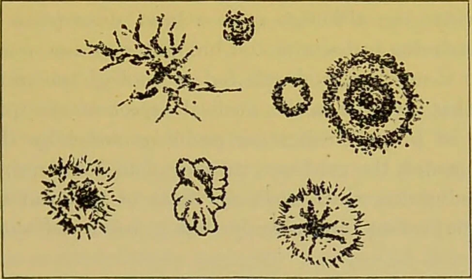 An illustration from The microscope : its history, construction, and application, being a familiar introduction to the use of the instrument, and the study of microscopical science / by Jabez Hogg., 1898, leaf 361