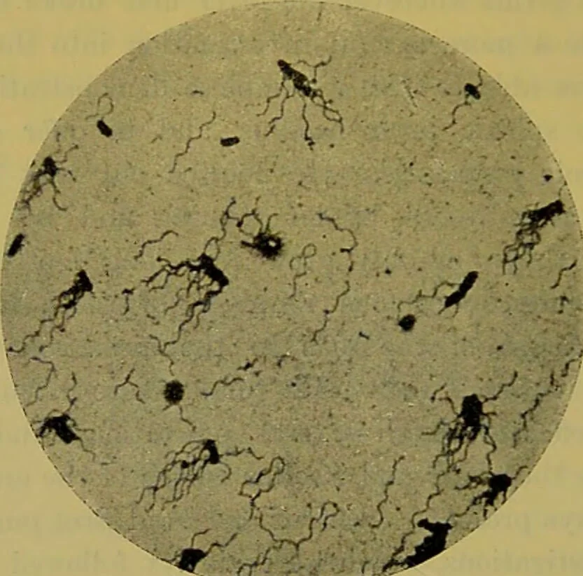 An illustration from The microscope : its history, construction, and application, being a familiar introduction to the use of the instrument, and the study of microscopical science / by Jabez Hogg., 1898, leaf 406
