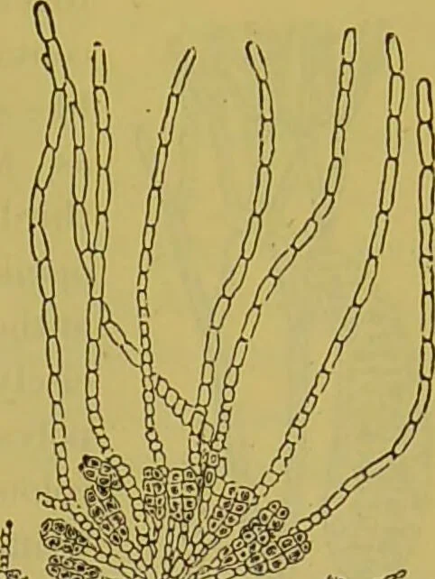 An illustration from The microscope : its history, construction, and application, being a familiar introduction to the use of the instrument, and the study of microscopical science / by Jabez Hogg., 1898, leaf 453