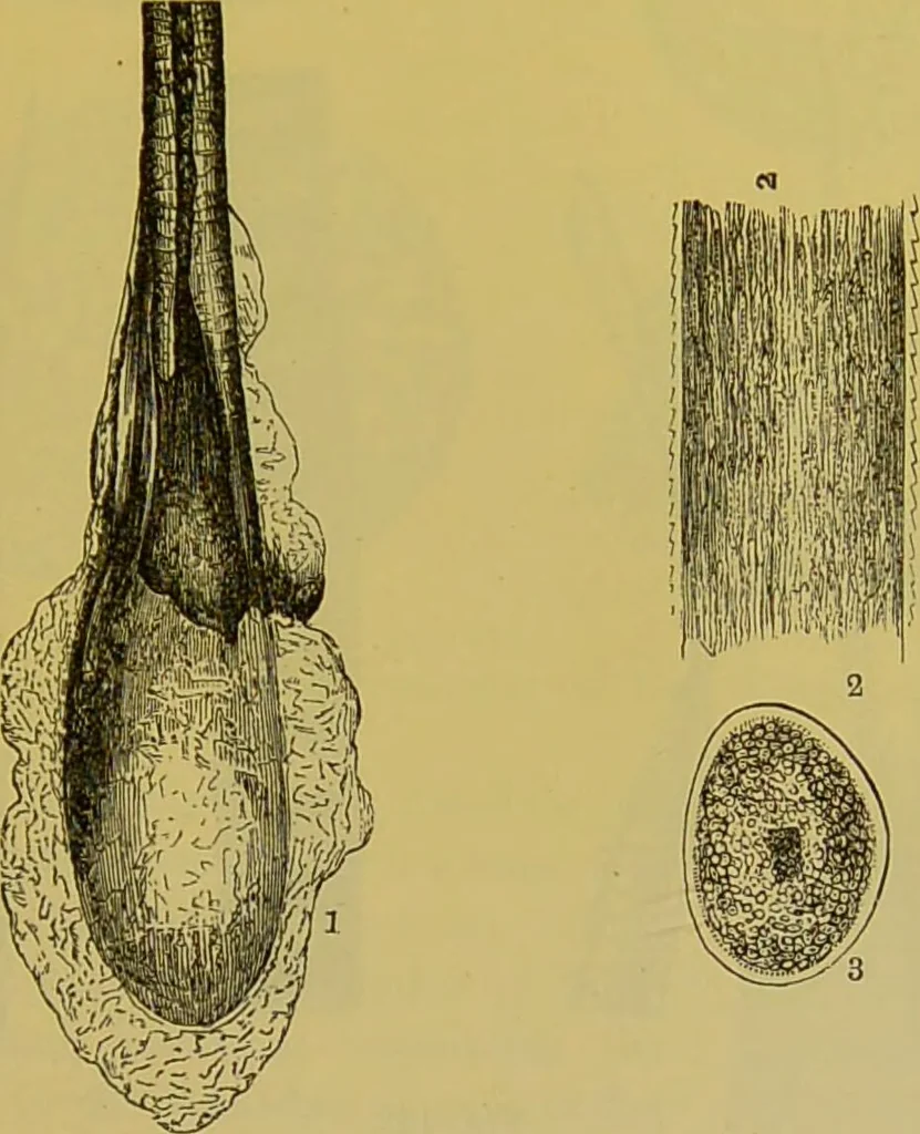 An illustration from The microscope : its history, construction, and application, being a familiar introduction to the use of the instrument, and the study of microscopical science / by Jabez Hogg., 1898, leaf 719