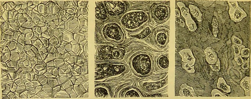 An illustration from The microscope : its history, construction, and application, being a familiar introduction to the use of the instrument, and the study of microscopical science / by Jabez Hogg., 1898, leaf 726