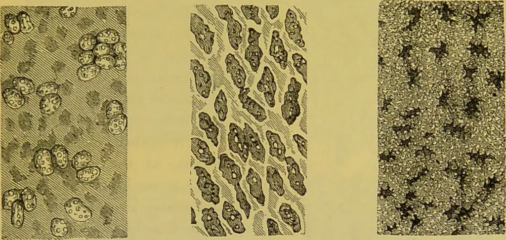 An illustration from The microscope : its history, construction, and application, being a familiar introduction to the use of the instrument, and the study of microscopical science / by Jabez Hogg., 1898, leaf 727
