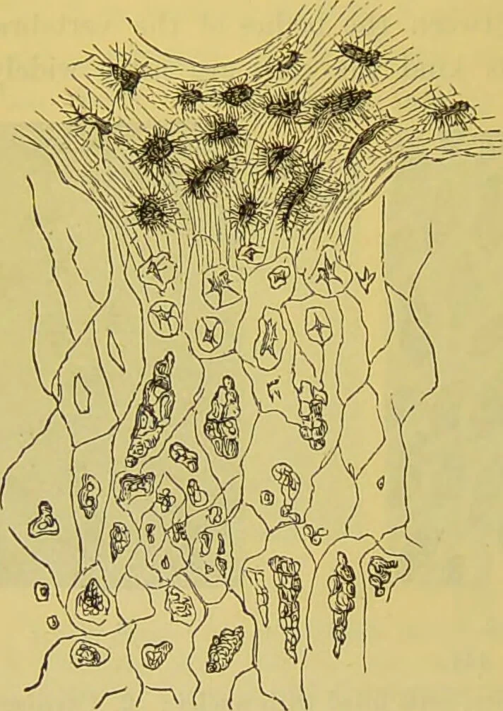 An illustration from The microscope : its history, construction, and application, being a familiar introduction to the use of the instrument, and the study of microscopical science / by Jabez Hogg., 1898, leaf 728