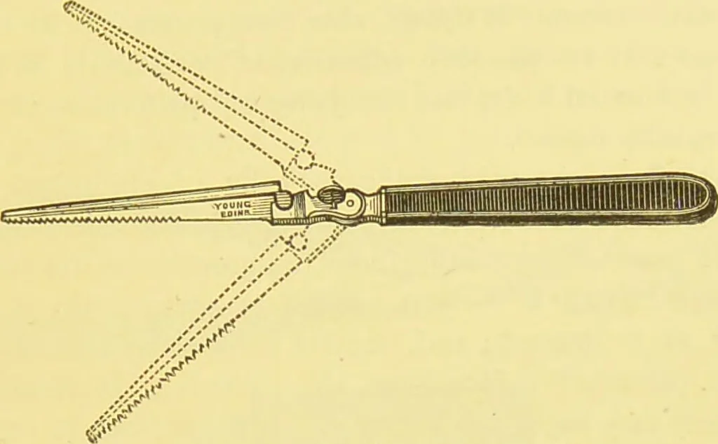An illustration from Diseases of the nose and throat / by F. de Havilland Hall ... With 2 coloured plates and 59 illustrations., 1894, leaf 85