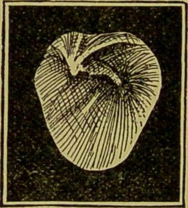 An illustration from Diseases of the ear, nose, and throat and their accessory cavities : A condensed text-book / By Seth Scott Bishop., 1897, leaf 104