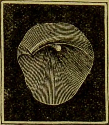 An illustration from Diseases of the ear, nose, and throat and their accessory cavities : A condensed text-book / By Seth Scott Bishop., 1897, leaf 116