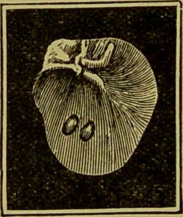 An illustration from Diseases of the ear, nose, and throat and their accessory cavities : A condensed text-book / By Seth Scott Bishop., 1897, leaf 116