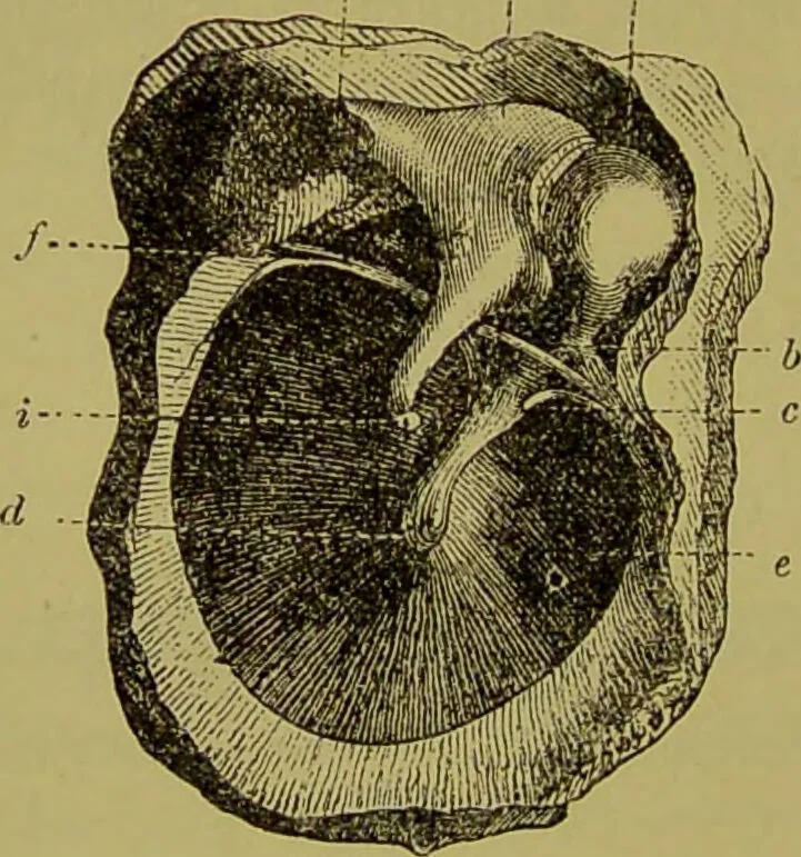 An illustration from Diseases of the ear, nose, and throat and their accessory cavities : A condensed text-book / By Seth Scott Bishop., 1897, leaf 126