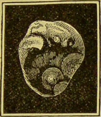 An illustration from Diseases of the ear, nose, and throat and their accessory cavities : A condensed text-book / By Seth Scott Bishop., 1897, leaf 139