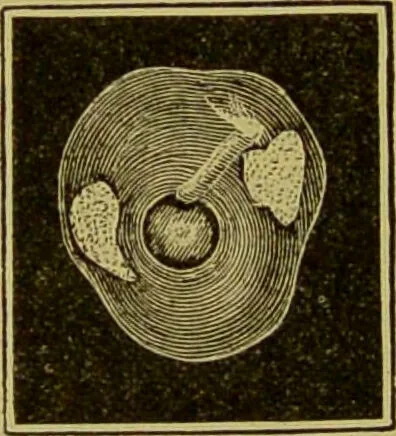 An illustration from Diseases of the ear, nose, and throat and their accessory cavities : A condensed text-book / By Seth Scott Bishop., 1897, leaf 150