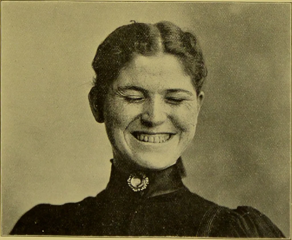An illustration from Diseases of the ear, nose, and throat and their accessory cavities : A condensed text-book / By Seth Scott Bishop., 1897, leaf 155