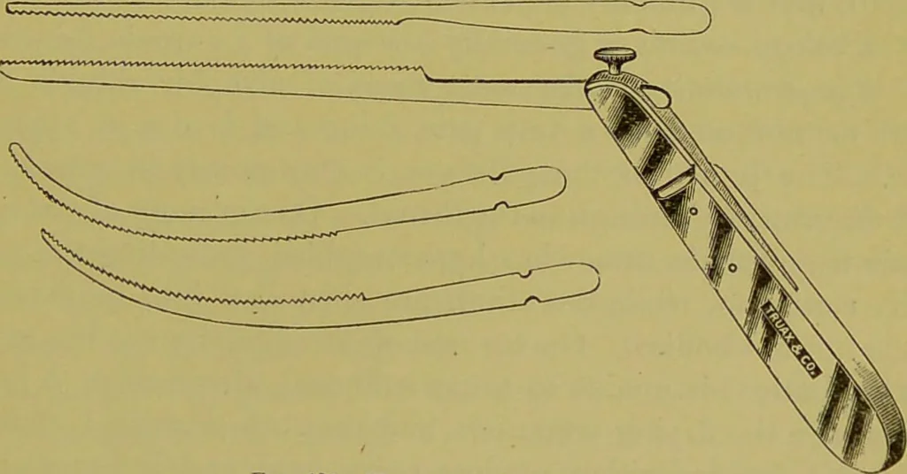 An illustration from Diseases of the ear, nose, and throat and their accessory cavities : A condensed text-book / By Seth Scott Bishop., 1897, leaf 305