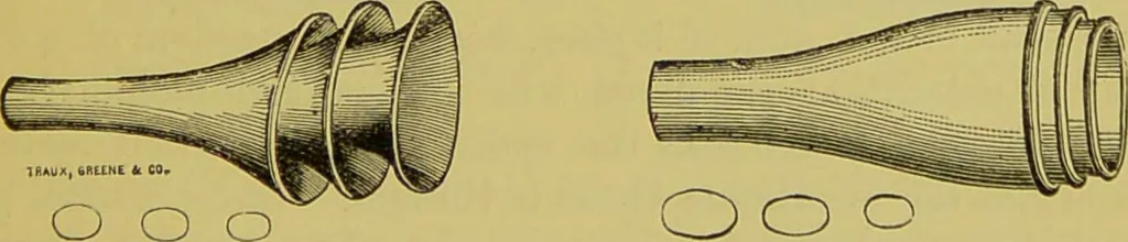 An illustration from Diseases of the ear, nose, and throat and their accessory cavities : A condensed text-book / By Seth Scott Bishop., 1897, leaf 39