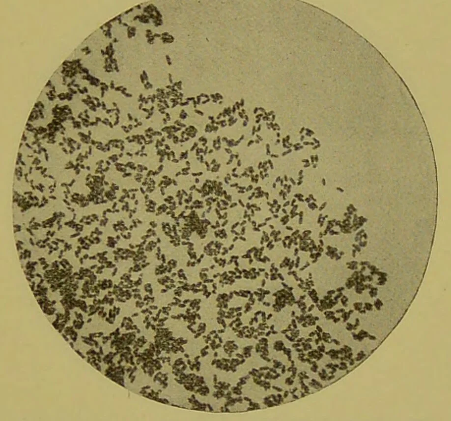 An illustration from Diseases of the ear, nose, and throat and their accessory cavities : A condensed text-book / By Seth Scott Bishop., 1897, leaf 393