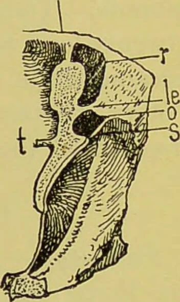 An illustration from Diseases of the ear, nose, and throat and their accessory cavities : A condensed text-book / By Seth Scott Bishop., 1897, leaf 87