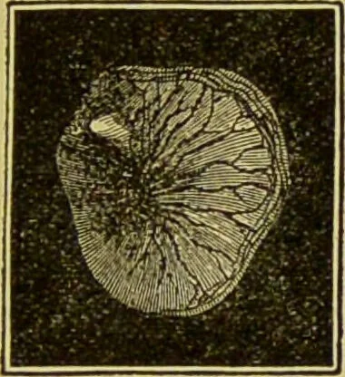 An illustration from Diseases of the ear, nose, and throat and their accessory cavities : A condensed text-book / By Seth Scott Bishop., 1897, leaf 93
